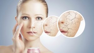 Les subtilités des soins pour la peau sèche