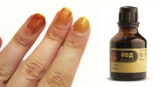 Ongles iodés: de l'effet à utiliser