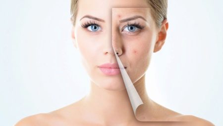 Comment soigner les peaux à problèmes?