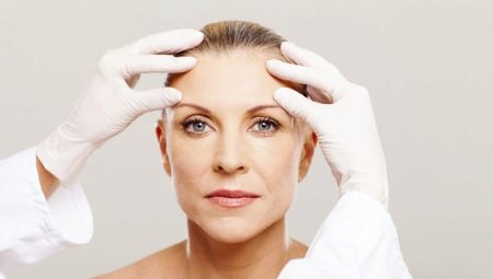 Facelift: le besoin de procédures et de règles