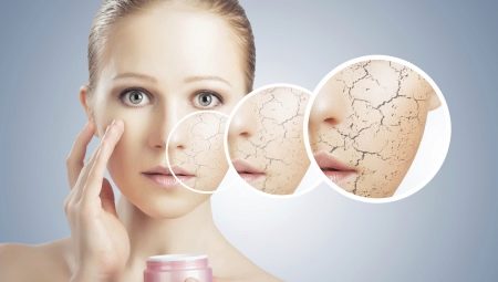 Les subtilités des soins pour la peau sèche
