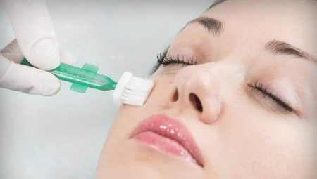 Peeling chimique: quand et comment peut-il être fait?