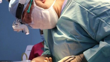 Caractéristiques de la procédure endoscopique lifting