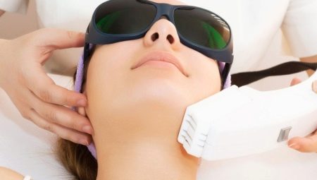 Peeling au laser: description de la procédure, avantages et inconvénients