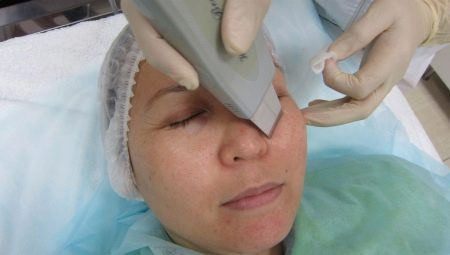 Règles pour le nettoyage du visage par ultrasons