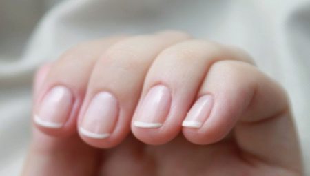 Causes et traitement de l'inflammation de la cuticule de l'ongle