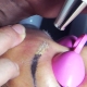Les détails du processus de détatouage au laser des sourcils