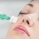 Peeling chimique: quand et comment peut-il être fait?