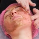 Peeling des coraux: de quoi s'agit-il et comment prendre soin de votre visage après?