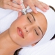 Microdermabrasion: caractéristiques et procédure