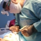 Caractéristiques de la procédure endoscopique lifting