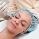 Rajeunissement facial au laser: caractéristiques, types et technologie de