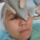 Règles pour le nettoyage du visage par ultrasons