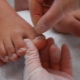 Ongles grandissent: causes et méthodes de traitement