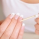 Matrice d'ongles: description, structure et causes des dommages