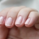 Causes et traitement de l'inflammation de la cuticule de l'ongle