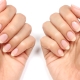 Ongles en couches: causes, traitement et prévention