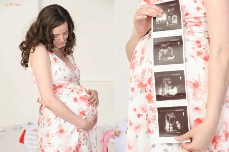 Photo d'une femme enceinte avec une échographie
